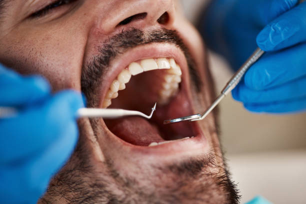 Best Knocked-Out Tooth (Avulsed Tooth) Treatment in El Mirage, AZ